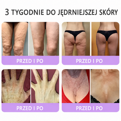 Skorzystaj z 50% ZNIŻKI przy dodaniu drugiego produktu😯