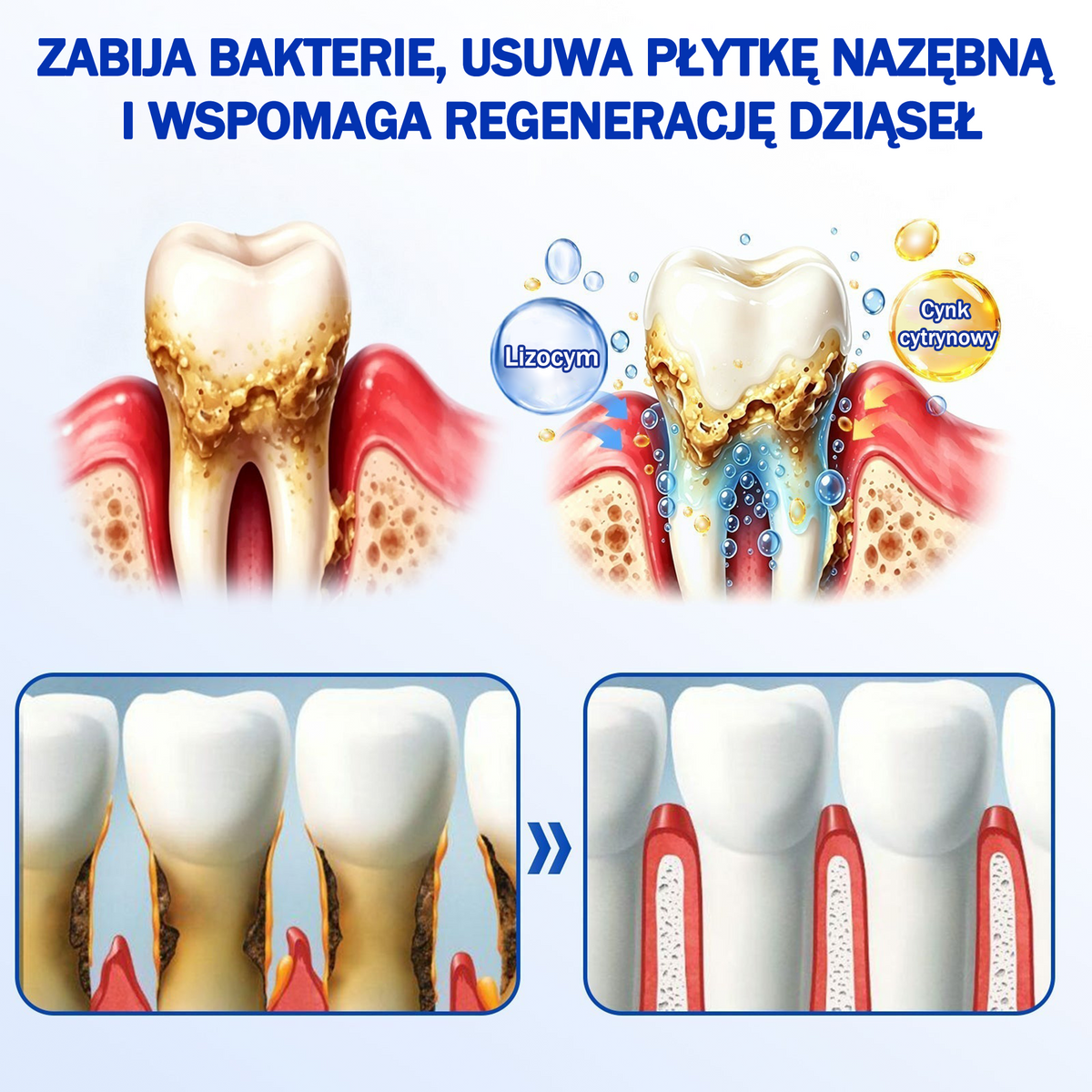 💖 Evolvion® GumRevive — żel do regeneracji i odbudowy dziąseł 🦷