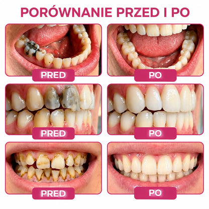 🧑‍⚕️Trilumia® 🦷 DenPerm – Naturalny żel do odbudowy szkliwa i wypełniania ubytków próchnicowych 🧊