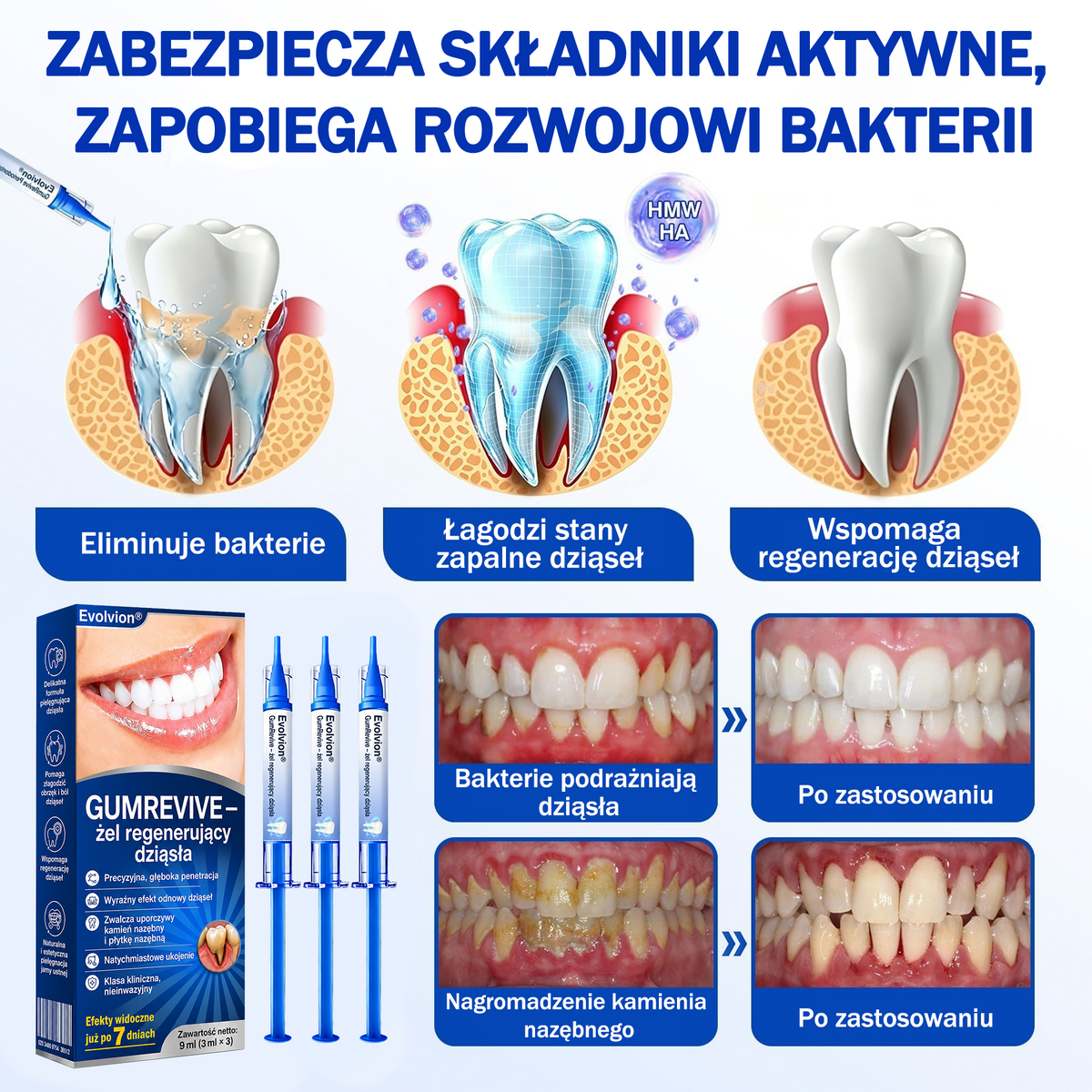 💖 Evolvion® GumRevive — żel do regeneracji i odbudowy dziąseł 🦷