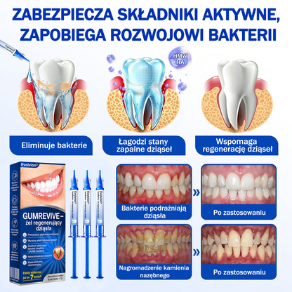 💖 Evolvion® GumRevive — żel do regeneracji i odbudowy dziąseł 🦷