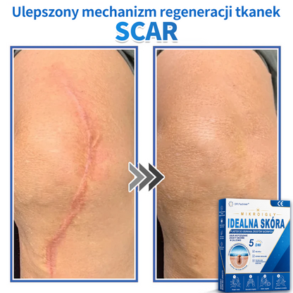 ✅📖 DR.Fachmer® Plaster mikroigłowy i hydrokoloid 2 w 1 | 👉Usuwające znamiona, trądzik, płaskie brodawki i zmiany skórne | Poprawia zmarszczki, blizny i przebarwienia | Niewidoczne plastry na pryszcze na twarz i ciało