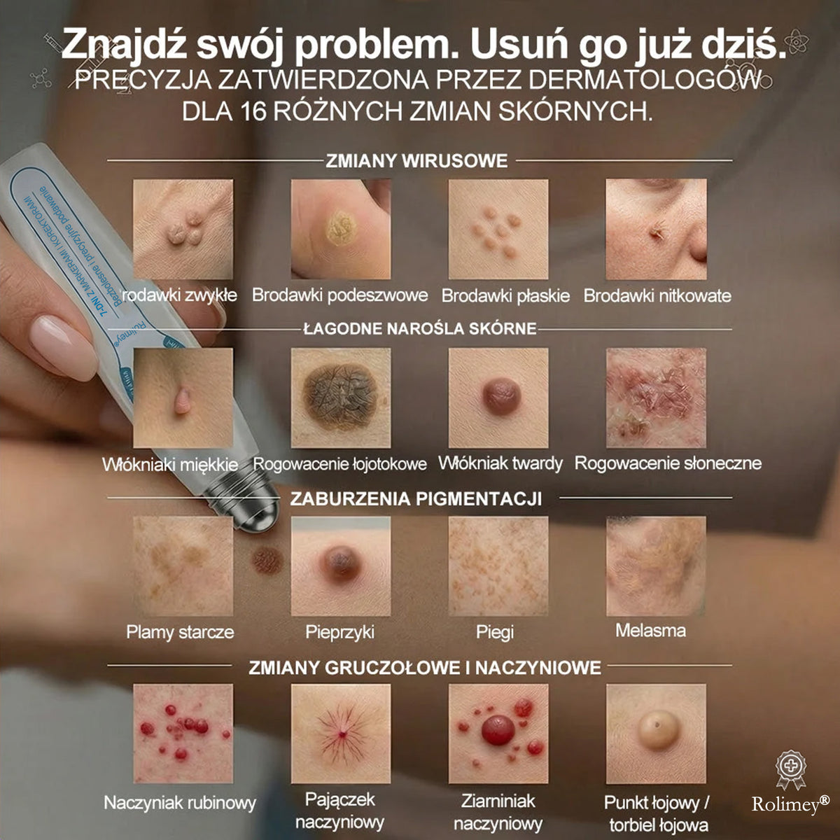 💛Oficjalny Sklep Markowy | ✅👩‍⚕️ Rolimey® 7-Dniowy 𝗧𝗮𝗴 & 𝗦𝗽𝗼𝐭 𝐄𝐫𝐚𝐬𝐞𝐫 (Bez bólu, Bez blizn – aplikator z kulką) 💛