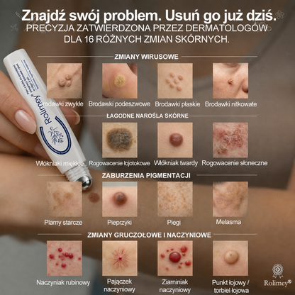 💖Oficjalny Sklep Markowy | ✅👩‍⚕️ Rolimey® 7-Dniowy 𝗧𝗮𝗴 & 𝗦𝗽𝗼𝐭 𝐄𝐫𝐚𝐬𝐞𝐫 (Bez bólu, Bez blizn – aplikator z kulką) 💖