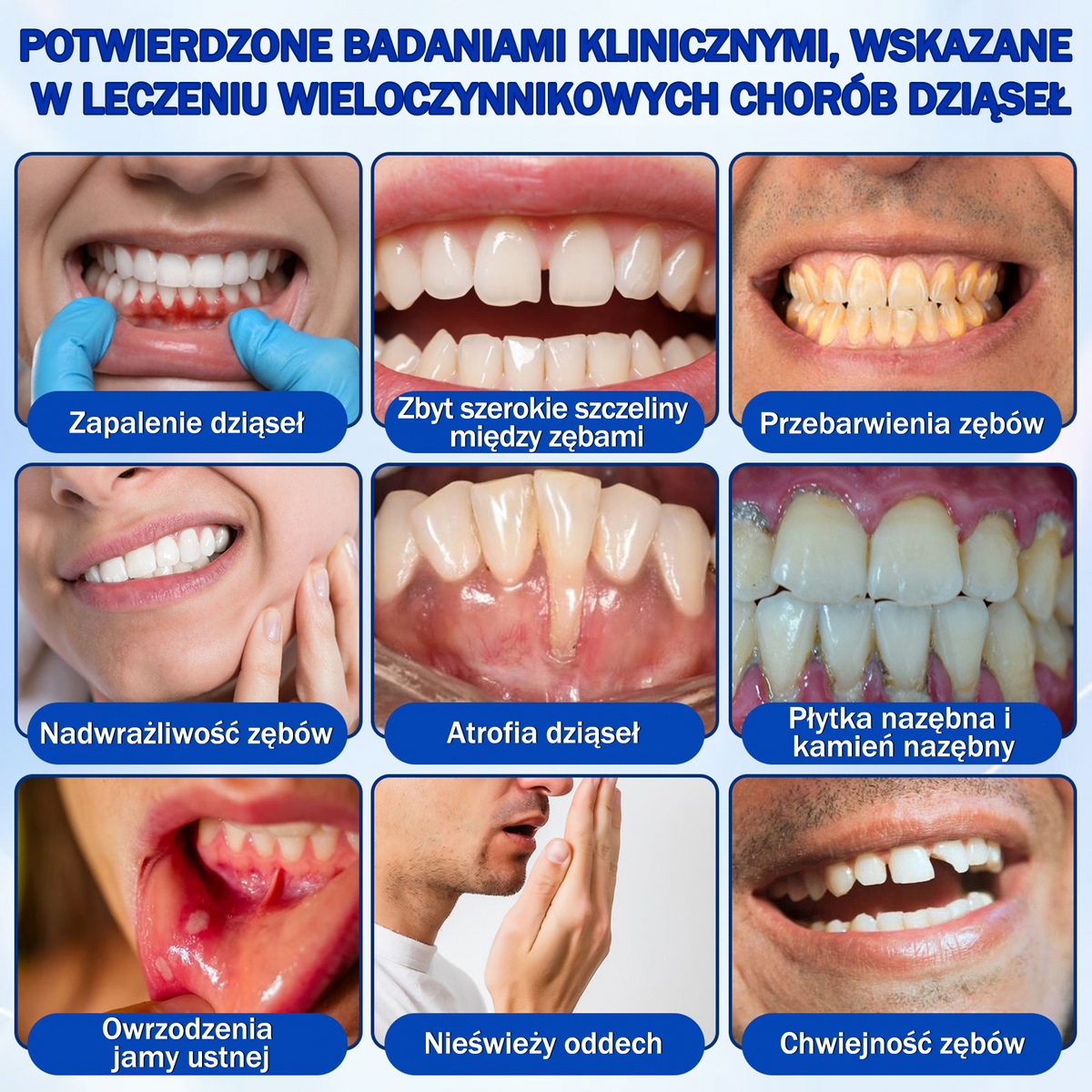 💖 Evolvion® GumRevive — żel do regeneracji i odbudowy dziąseł 🦷
