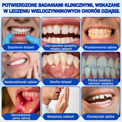 💖 Evolvion® GumRevive — żel do regeneracji i odbudowy dziąseł 🦷