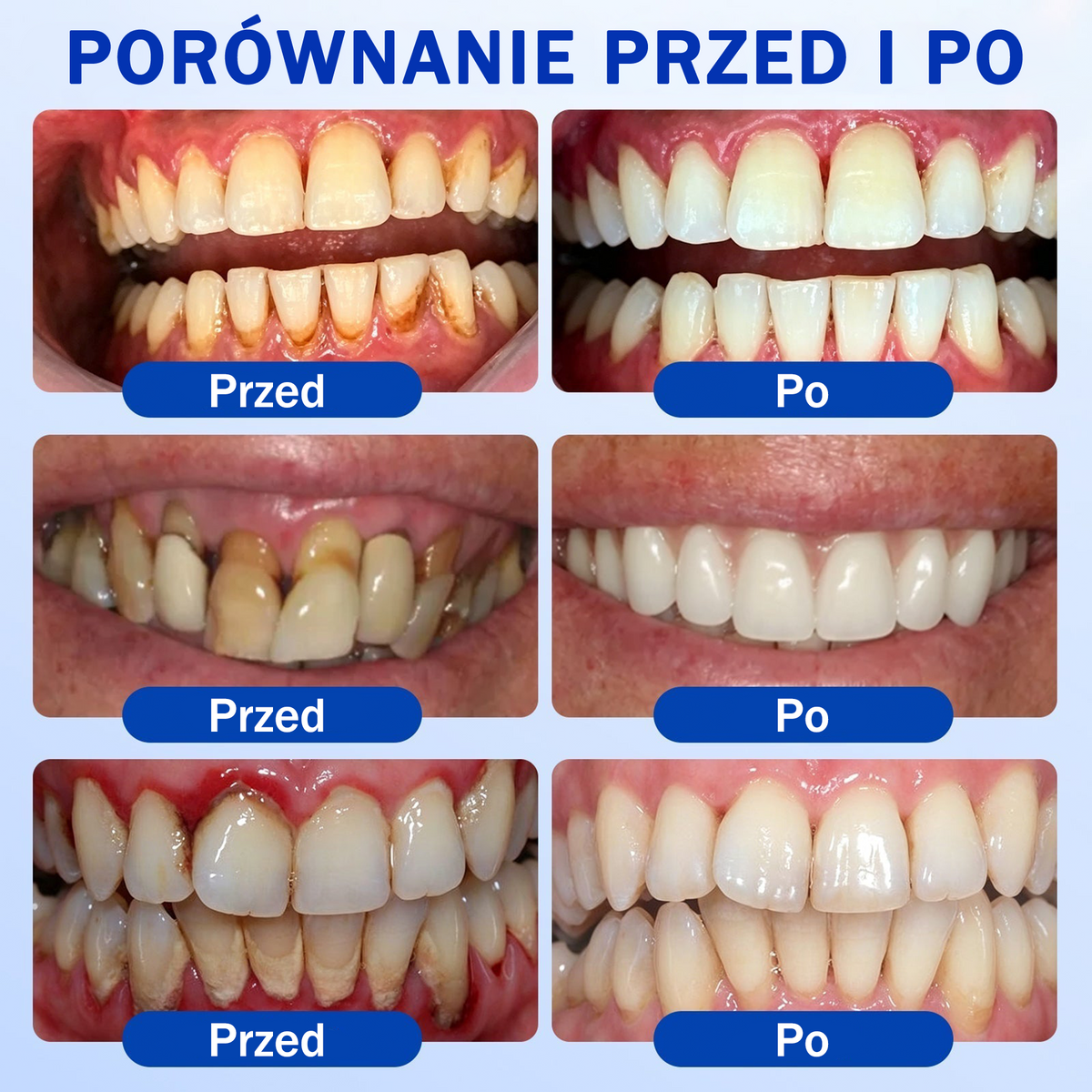 💖 Evolvion® GumRevive — żel do regeneracji i odbudowy dziąseł 🦷