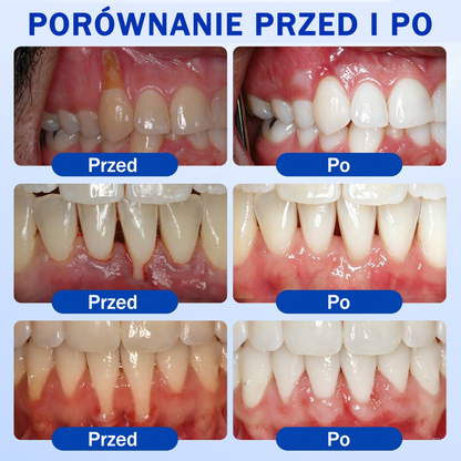 💖 Evolvion® GumRevive — żel do regeneracji i odbudowy dziąseł 🦷