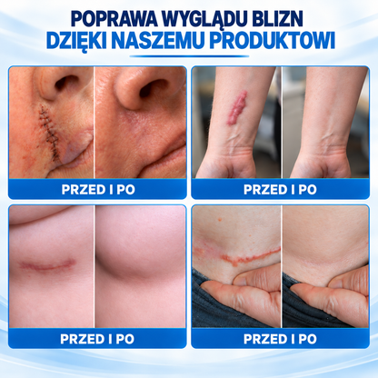 Dr.Fachmer® 🏠 Bio-regeneracyjny plaster mikroigłowy na blizny – silikonowa pielęgnacja blizn z proteinami regenerującymi