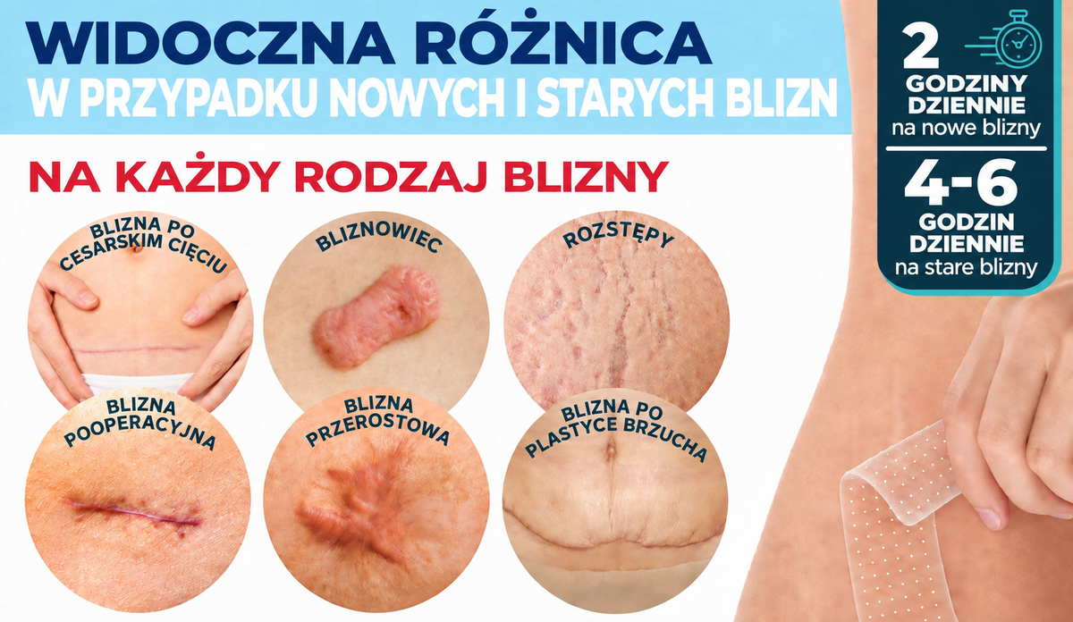 Dr.Fachmer® 🏠 Bio-regeneracyjny plaster mikroigłowy na blizny – silikonowa pielęgnacja blizn z proteinami regenerującymi