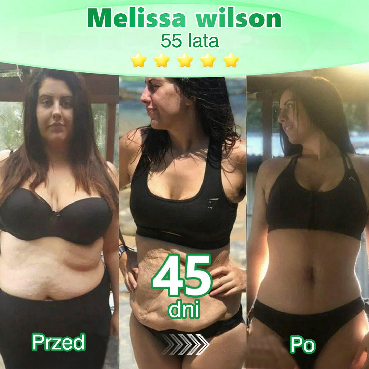 🍈Nowość w 2026: 𝑮𝑭𝑶𝑼𝑲® 𝑩𝒆𝒓𝒃𝒆𝒓𝒊𝒏𝒆 6‑w‑1 𝑵𝒂𝒏𝒐 𝑴𝒊𝒄𝒓𝒐𝒏𝒆𝒆𝒅𝒍𝒆 plaster z formułą wspieraną naukowo.