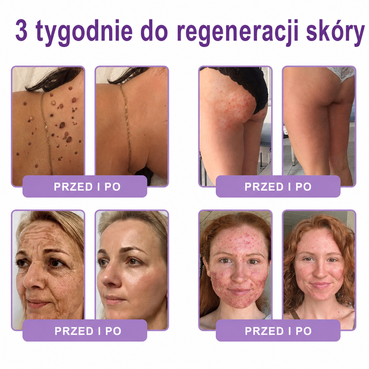 Skorzystaj z 50% ZNIŻKI przy dodaniu drugiego produktu😯