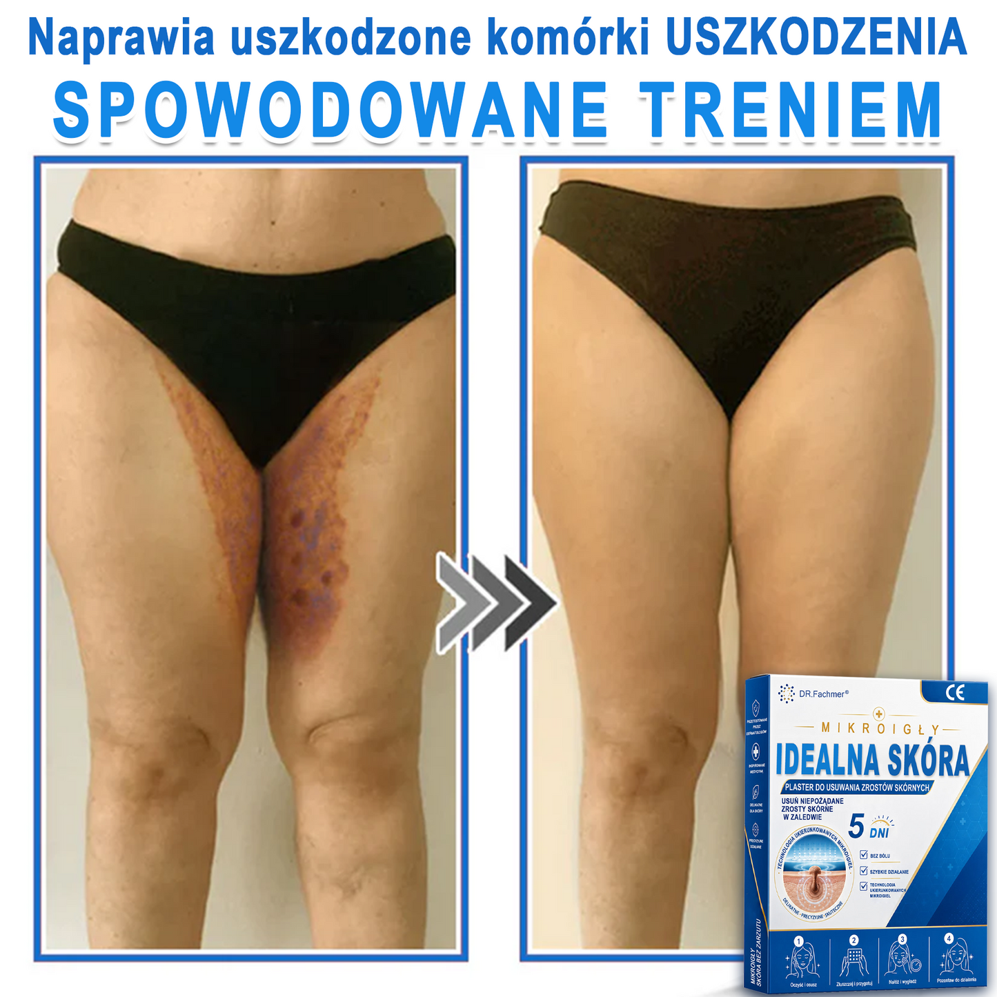 ✅📖 DR.Fachmer® Plaster mikroigłowy i hydrokoloid 2 w 1 | 👉Usuwające znamiona, trądzik, płaskie brodawki i zmiany skórne | Poprawia zmarszczki, blizny i przebarwienia | Niewidoczne plastry na pryszcze na twarz i ciało