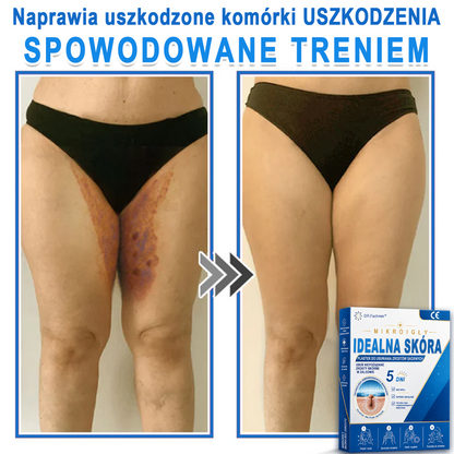 ✅📖 DR.Fachmer® Plaster mikroigłowy i hydrokoloid 2 w 1 | 👉Usuwające znamiona, trądzik, płaskie brodawki i zmiany skórne | Poprawia zmarszczki, blizny i przebarwienia | Niewidoczne plastry na pryszcze na twarz i ciało