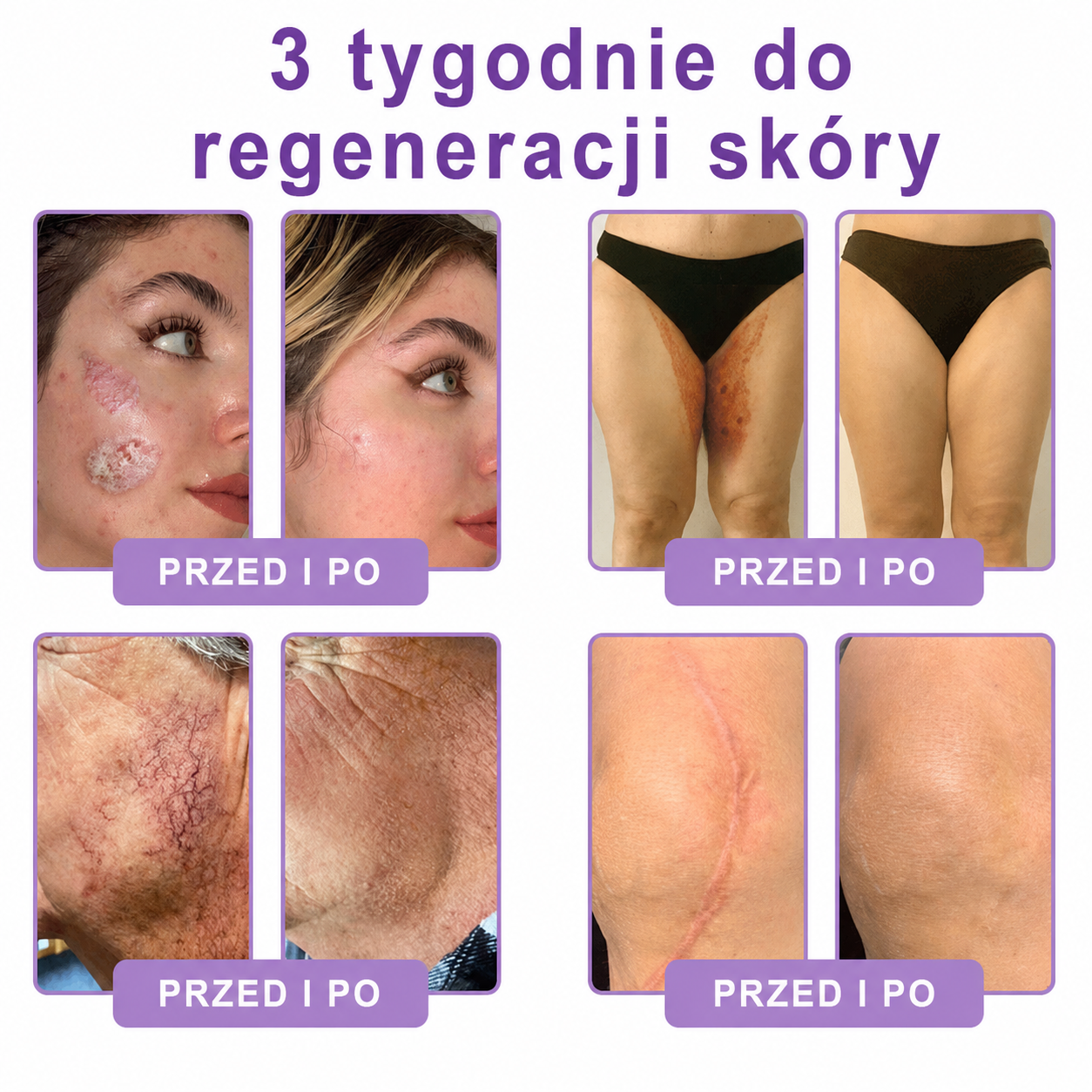 Skorzystaj z 50% ZNIŻKI przy dodaniu drugiego produktu😯
