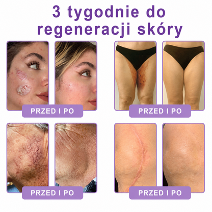 Skorzystaj z 50% ZNIŻKI przy dodaniu drugiego produktu😯