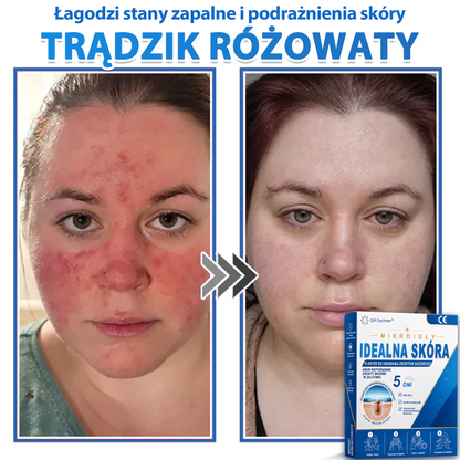 ✅📖 DR.Fachmer® Plaster mikroigłowy i hydrokoloid 2 w 1 | 👉Usuwające znamiona, trądzik, płaskie brodawki i zmiany skórne | Poprawia zmarszczki, blizny i przebarwienia | Niewidoczne plastry na pryszcze na twarz i ciało