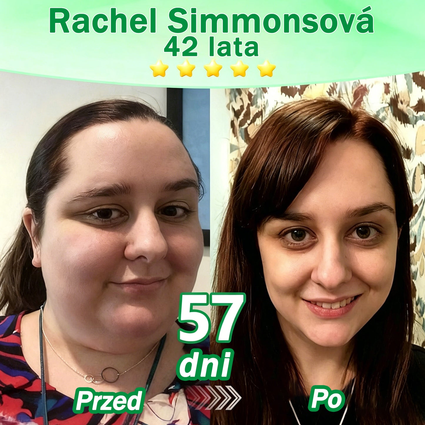 🍈Nowość w 2026: 𝑮𝑭𝑶𝑼𝑲® 𝑩𝒆𝒓𝒃𝒆𝒓𝒊𝒏𝒆 6‑w‑1 𝑵𝒂𝒏𝒐 𝑴𝒊𝒄𝒓𝒐𝒏𝒆𝒆𝒅𝒍𝒆 plaster z formułą wspieraną naukowo.