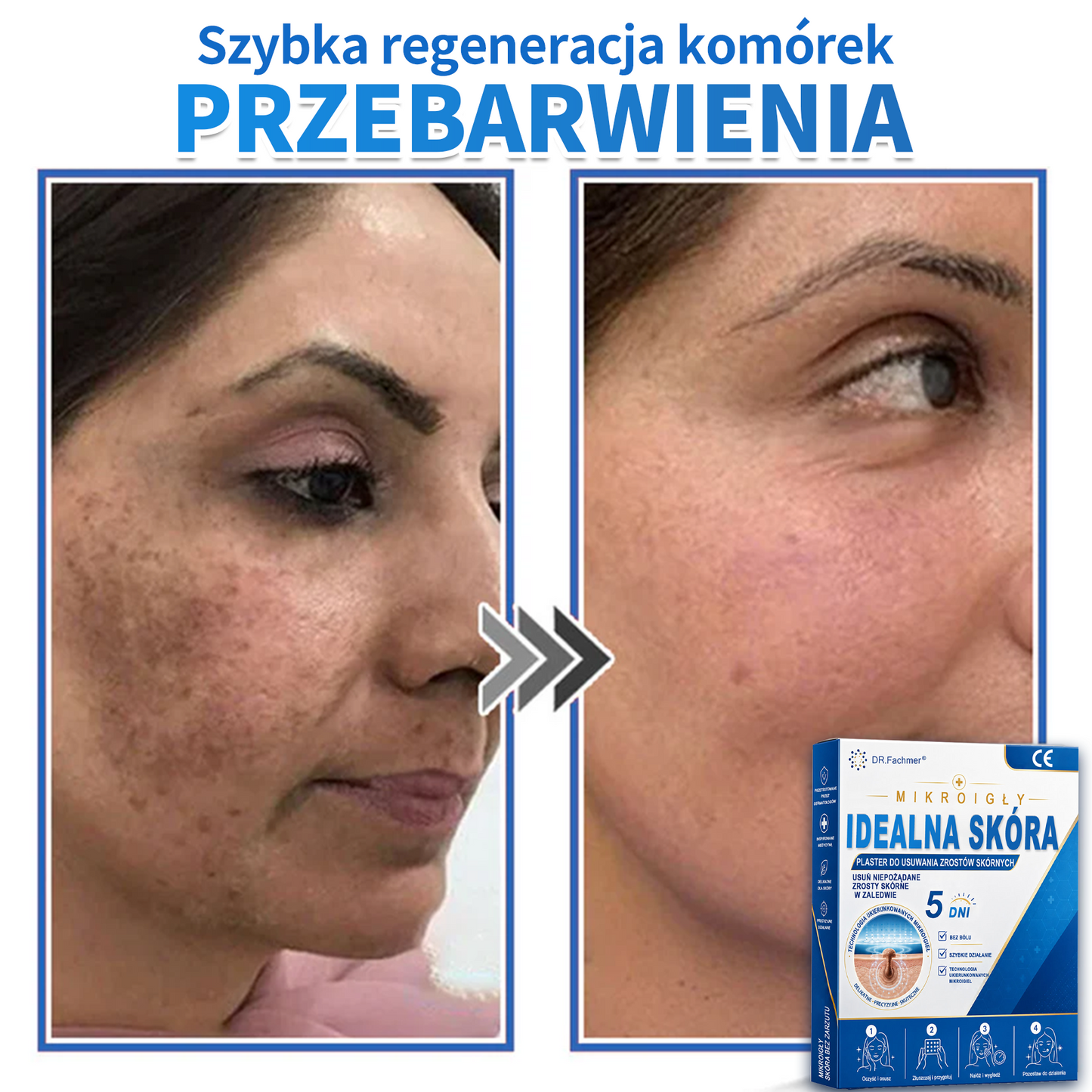 ✅📖 DR.Fachmer® Plaster mikroigłowy i hydrokoloid 2 w 1 | 👉Usuwające znamiona, trądzik, płaskie brodawki i zmiany skórne | Poprawia zmarszczki, blizny i przebarwienia | Niewidoczne plastry na pryszcze na twarz i ciało