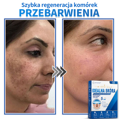 ✅📖 DR.Fachmer® Plaster mikroigłowy i hydrokoloid 2 w 1 | 👉Usuwające znamiona, trądzik, płaskie brodawki i zmiany skórne | Poprawia zmarszczki, blizny i przebarwienia | Niewidoczne plastry na pryszcze na twarz i ciało