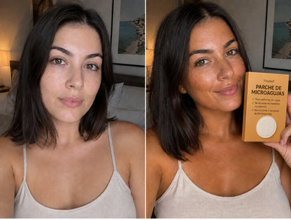 🔥🔥 Do 70% ZNIŻKI na Plastry Brązujące SunFree od Trilumia® 🤎 Złocista opalenizna bez promieni UV 🌟 Naturalny blask nawet przez 14 dni