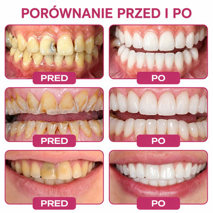🧑‍⚕️Trilumia® 🦷 DenPerm – Naturalny żel do odbudowy szkliwa i wypełniania ubytków próchnicowych 🧊